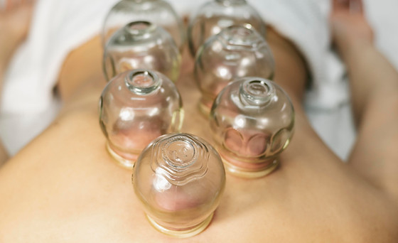 CUPPING